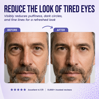 Nuvora™ Eye Repair Patches