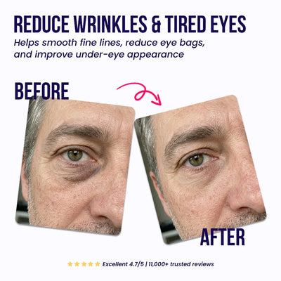 Nuvora™ Eye Repair Patches